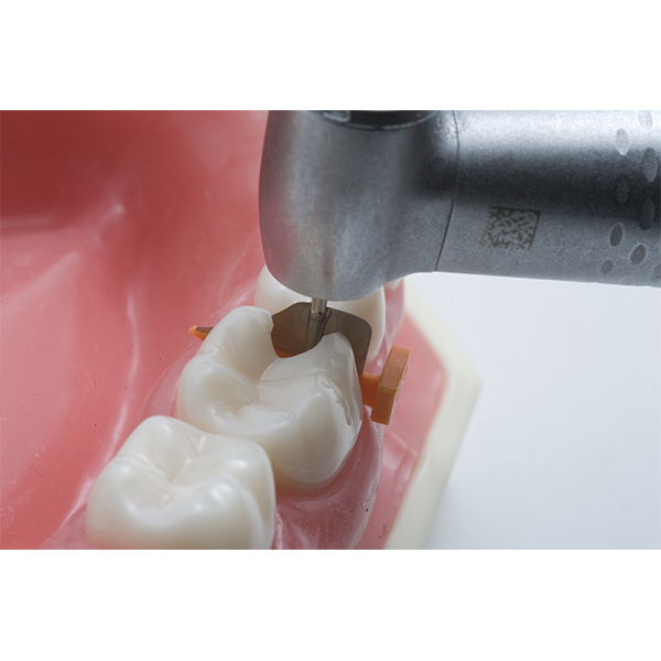 FenderWedge assorterede, 4 x 36 stk.