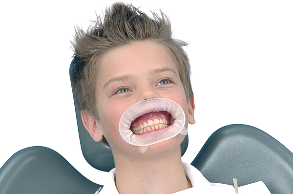 OptraGate junior, 80 stk.