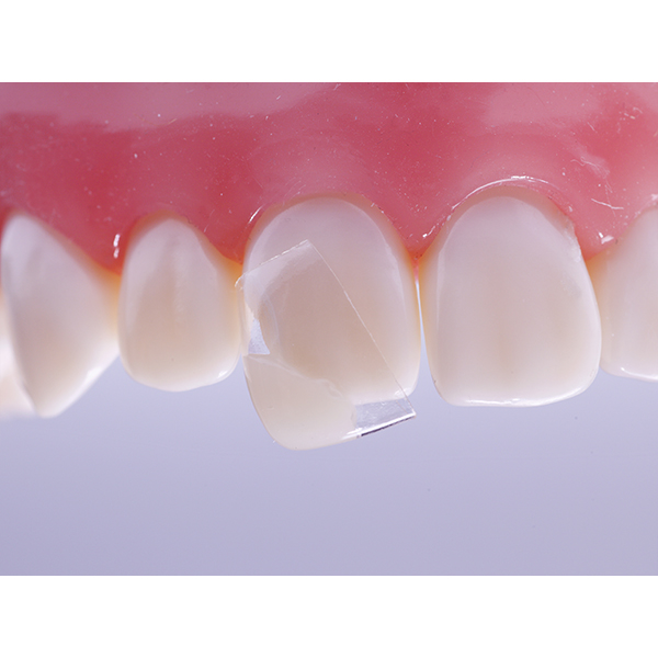 Directa CoForm nr. 11 mesial, 4 x 2 stk.